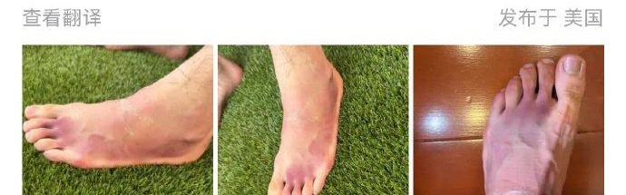 必发官网-美网商竣程因左脚淤血退赛，父亲商毅通报伤情